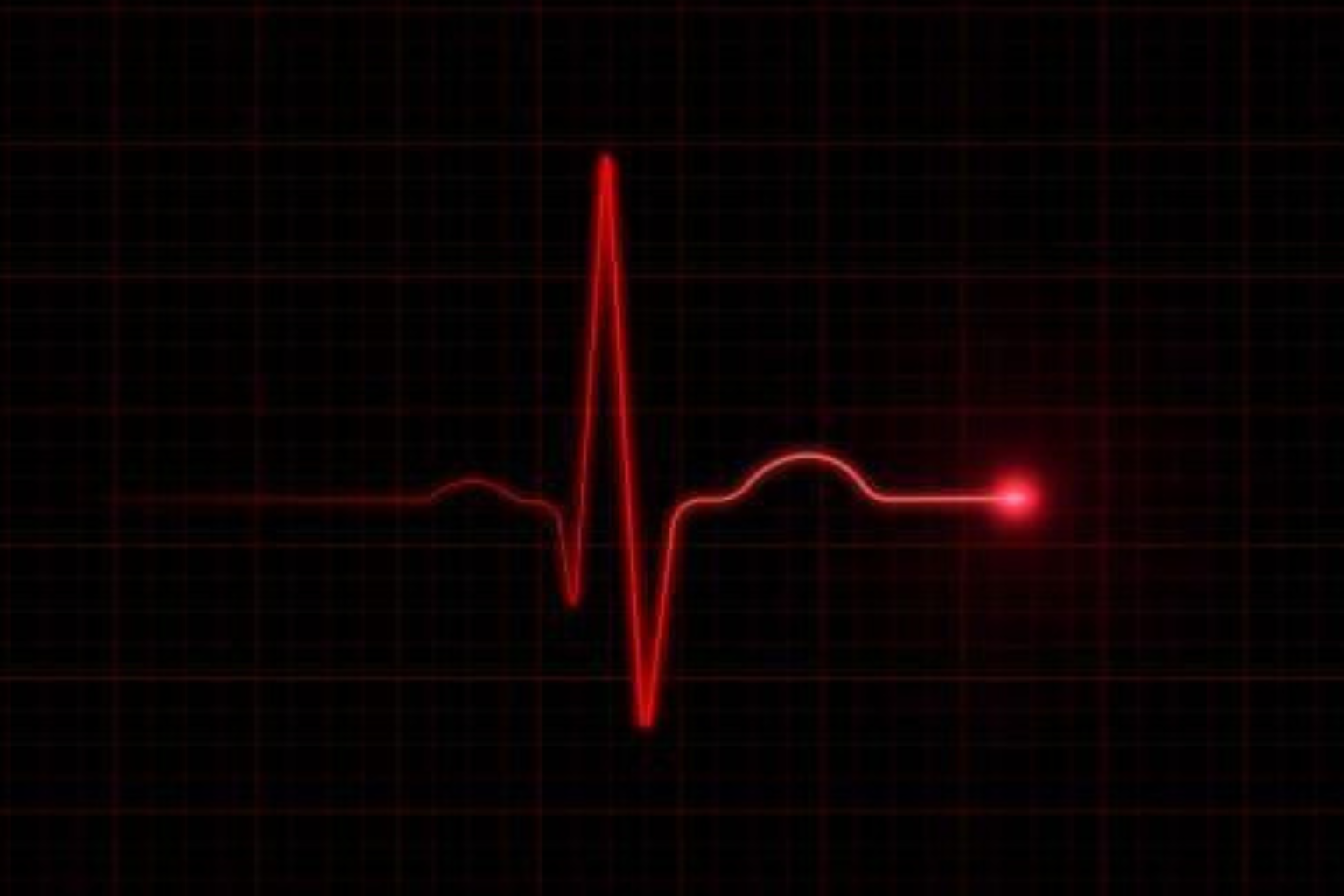 DIAGNÓSTICO: Novas Regras Redefinem o Que é Pressão Arterial Normal 